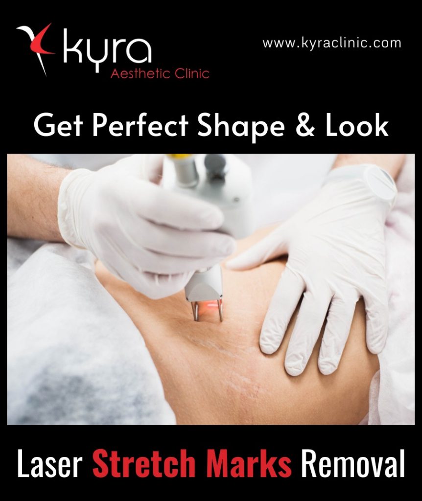STRETCH MARKS Kyraclinic