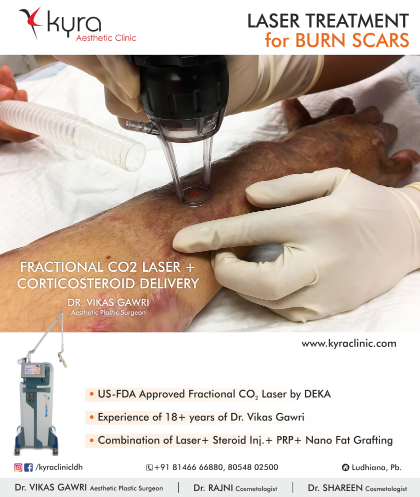 laser-burn-scar laser burn scar
