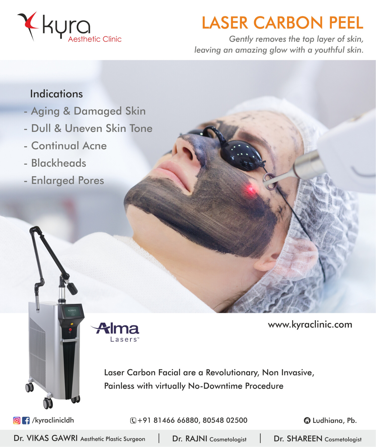 laser-carbon-peel Laser Carbon Peel