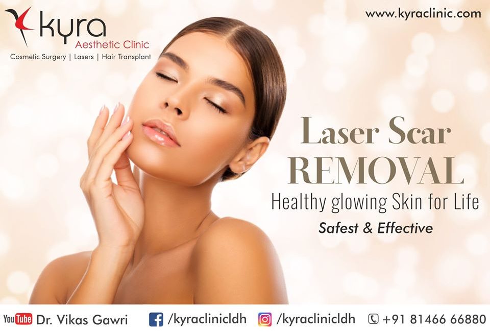 laser-scar-removal laser-scar-removal