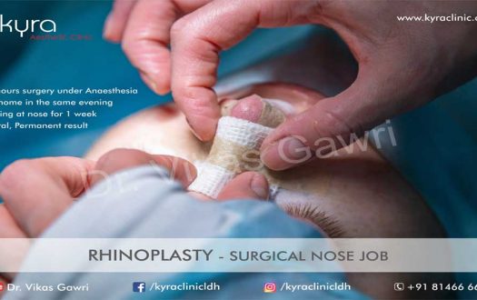 septo-rhinoplasty septo-rhinoplasty