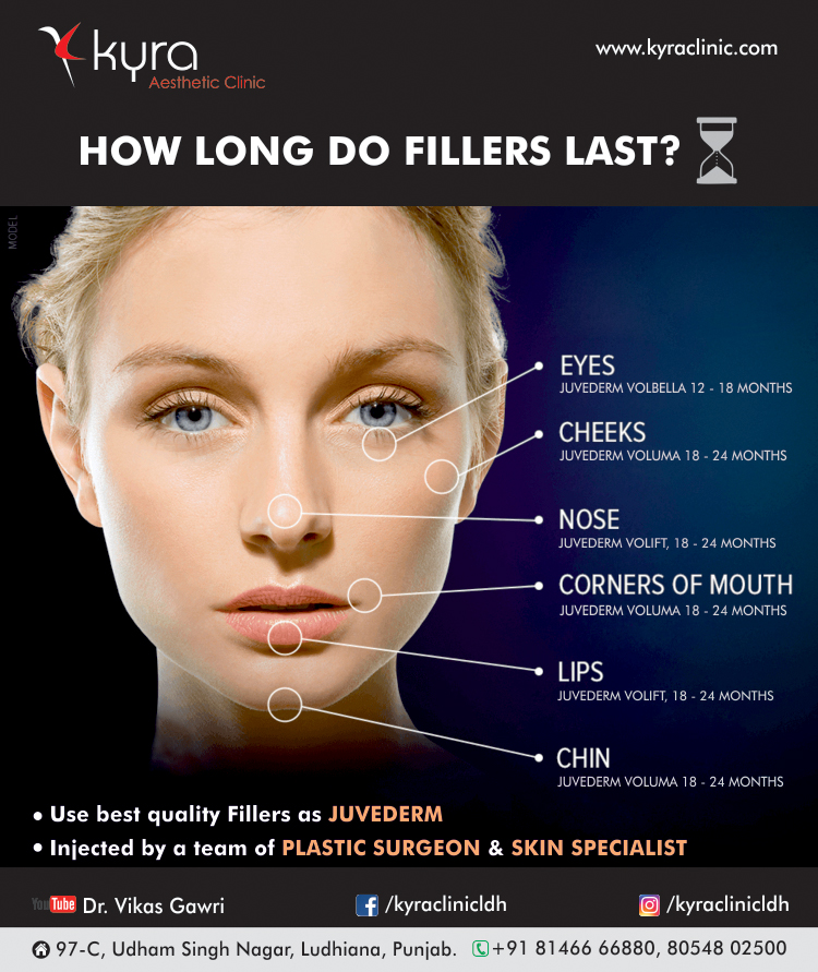 HOW LONG DO FILLER LAST Small HOW LONG DO FILLER LAST Small