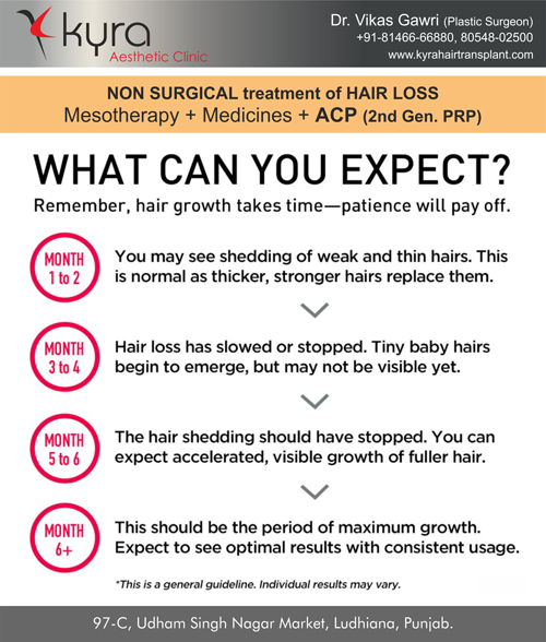 What can you expect prp for hair treatment