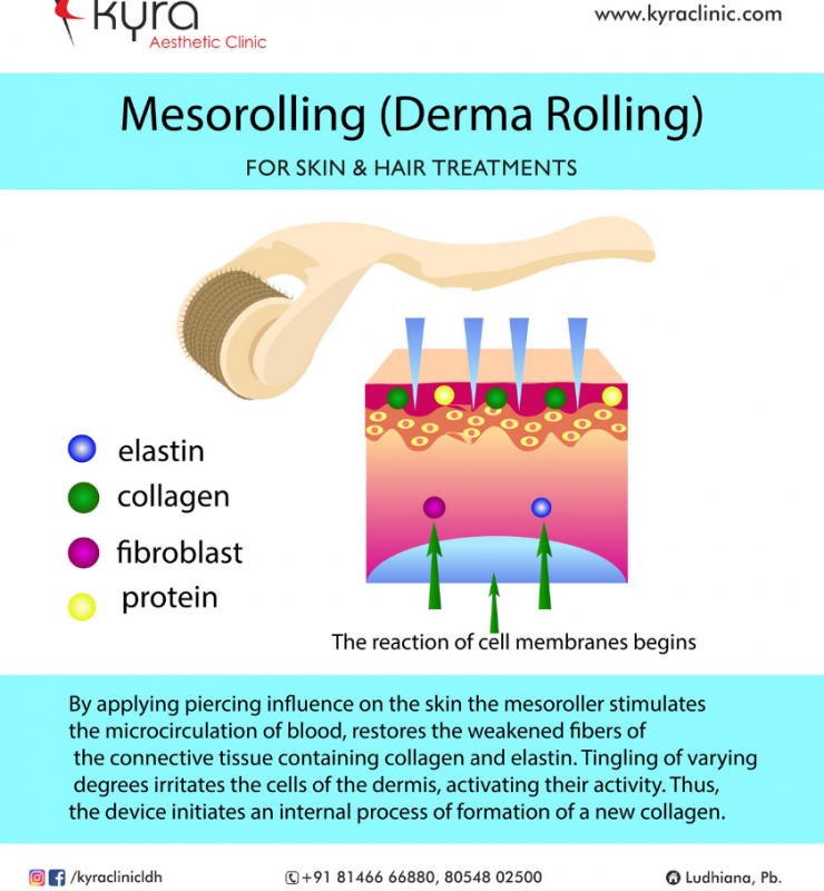 mesorolling derma rolling
