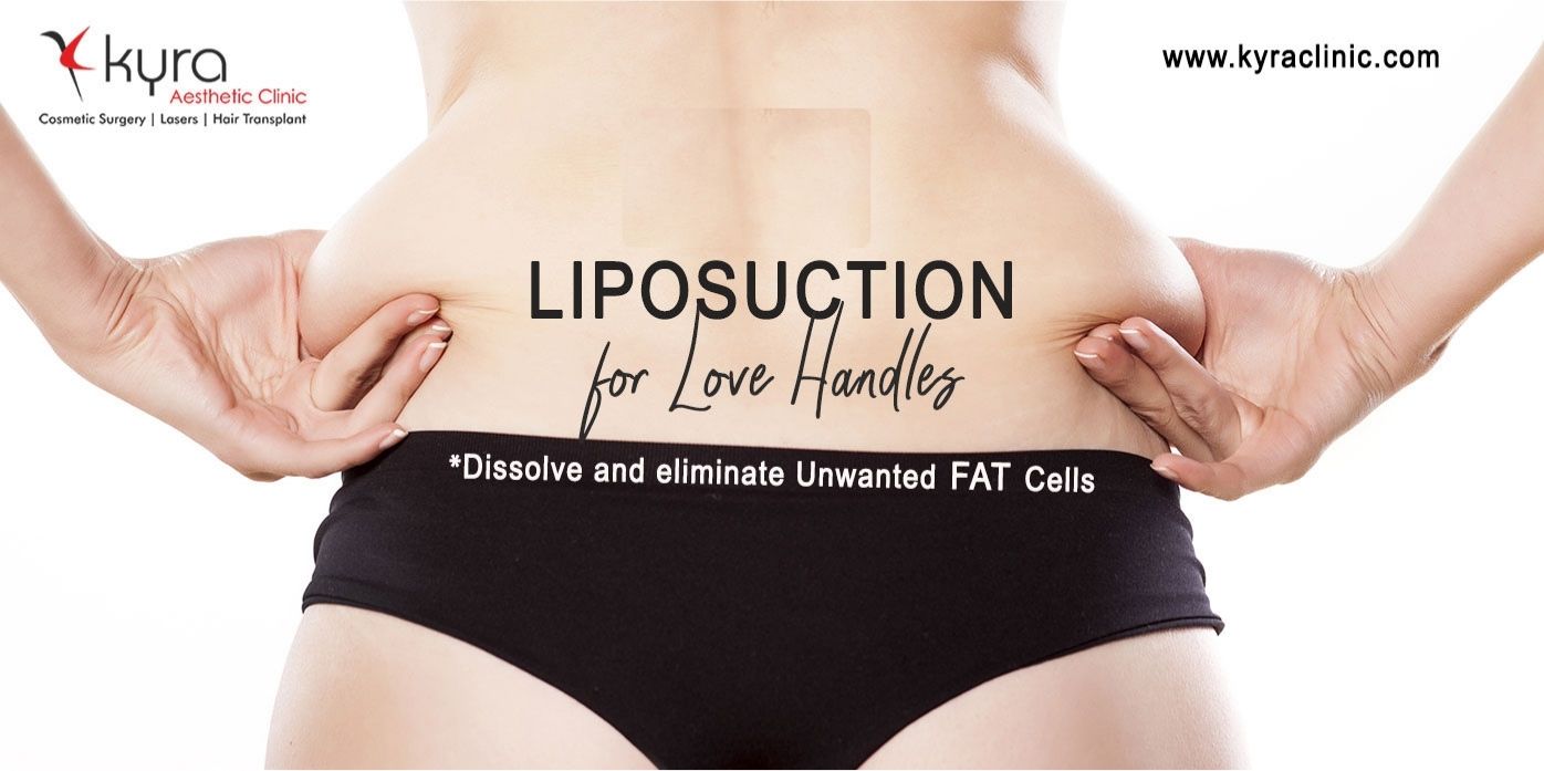 vaser liposuction love handles