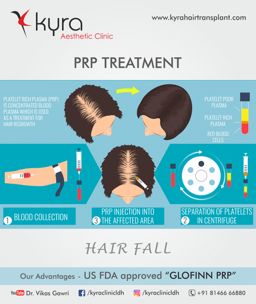 PRP for Hair loss - Cosmetic Surgery in Ludhiana, Plastic Surgery in Punjab, Laser and Cosmetic Surgeon in Ludhiana, Punjab, India PRP for Hair loss - Cosmetic Surgery in Ludhiana, Plastic Surgery in Punjab, Laser and Cosmetic Surgeon in Ludhiana, Punjab, India