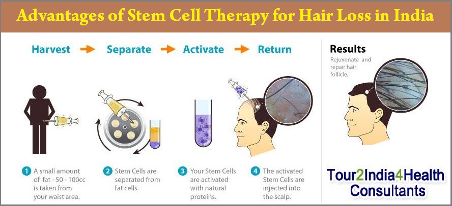 Stem Cells for Hair Thinning - Cosmetic Surgery in Ludhiana, Plastic  Surgery in Punjab, Laser and Cosmetic Surgeon in Ludhiana, Punjab, India