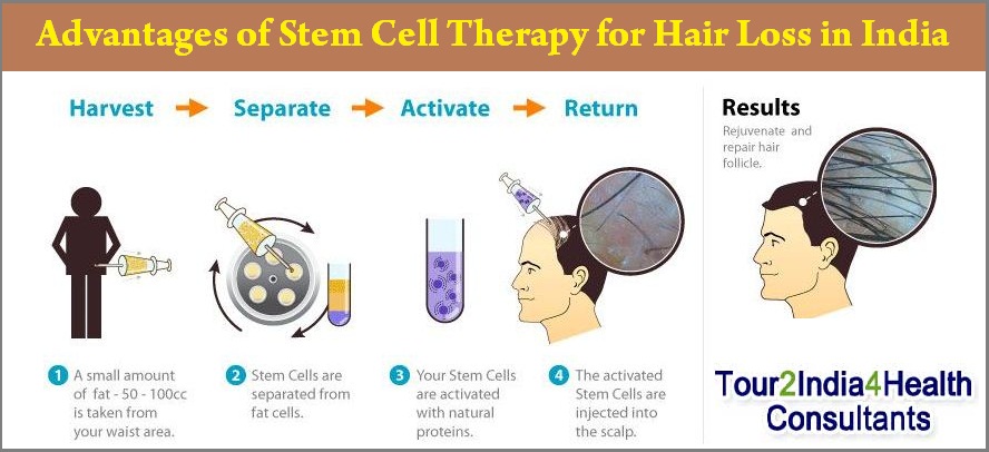 Stem Cells for Hair Thinning - Cosmetic Surgery in Ludhiana, Plastic Surgery in Punjab, Laser and Cosmetic Surgeon in Ludhiana, Punjab, India Stem Cells for Hair Thinning - Cosmetic Surgery in Ludhiana, Plastic Surgery in Punjab, Laser and Cosmetic Surgeon in Ludhiana, Punjab, India