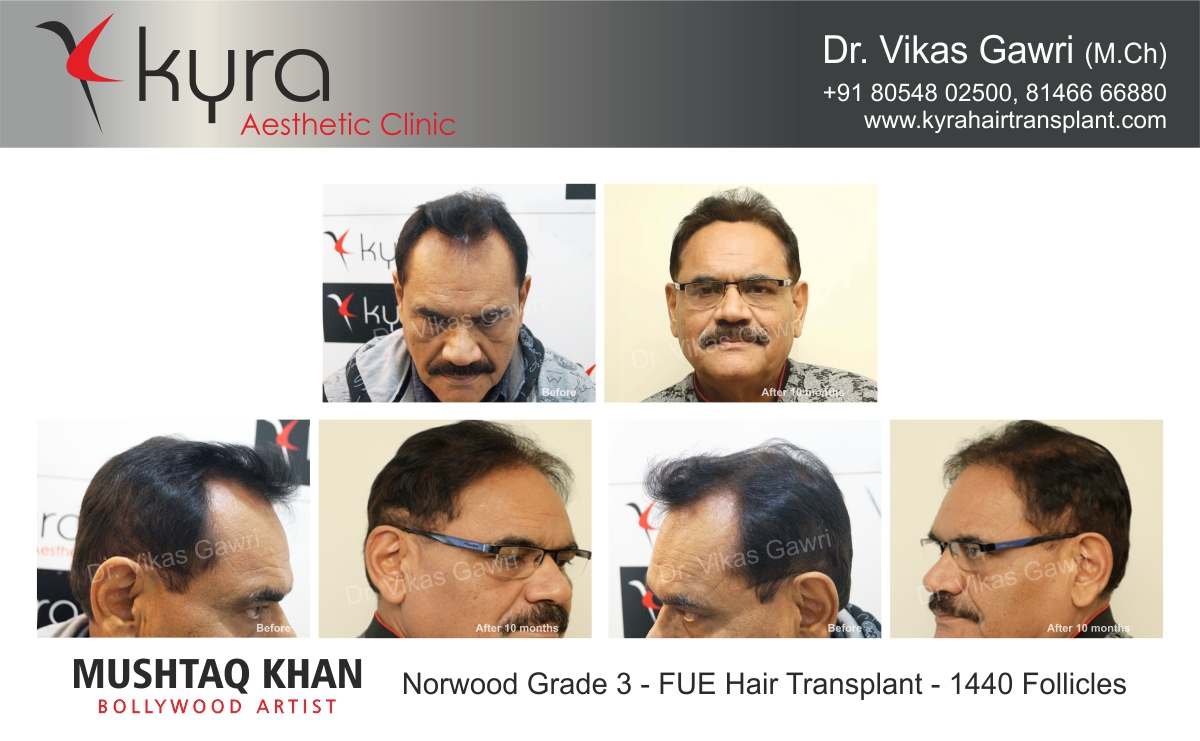 Dr Feroz Khan  Cosmetologist  Book Appointment Online View Fees  Feedbacks  Practo