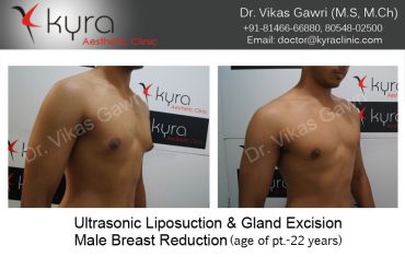 Gayvideo in Ludhiana