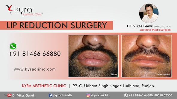 Upper Lip Fat Reduction - Cosmetic Surgery in Ludhiana, Plastic Surgery in  Punjab, Laser and Cosmetic Surgeon in Ludhiana, Punjab, India
