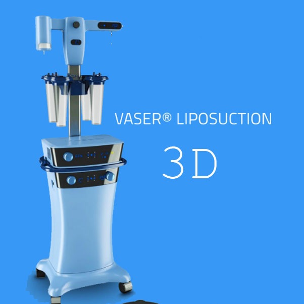 Ultrasonic Liposuction LYSONIX