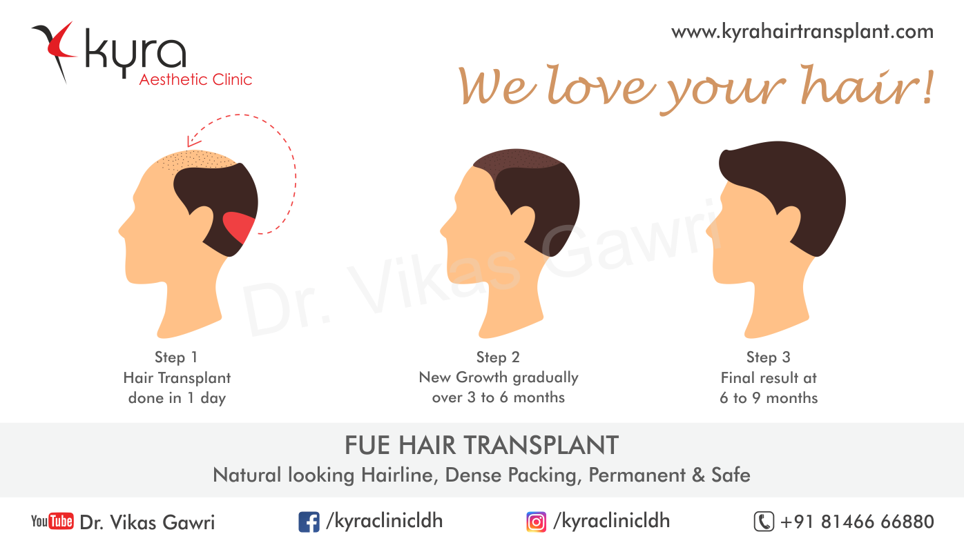 Hair Fall Doctor Near Me - Cosmetic Surgery in Ludhiana, Plastic Surgery in  Punjab, Laser and Cosmetic Surgeon in Ludhiana, Punjab, India